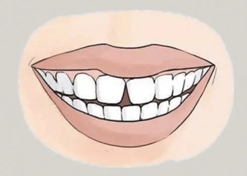 <a href=http://www.axpjc.cn/news_article?news_id=116>一次性口腔探针</a>